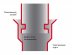 Дымоход Шидель Permeter ULTRA 25 комплект для насадного монтажа
